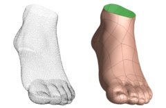 Automatic reconstruction of B-spline surfaces of arbitrary topological type